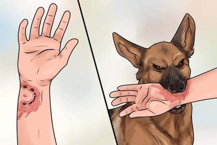 Симптомы при укусе собак